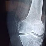 Strong Bones, Healthy Life