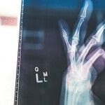 Strong Bones, Healthy Life