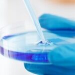 New Treatments in the Fight Against Melanoma