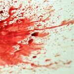 Bloody Nose
