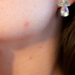 Improve Complexion With Home Remedies