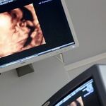 The Left's War With Biological Reality