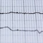 Obamacare: Will the Senate Let It Live?