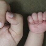 In Health Care, We'll Take Baby Steps
