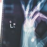Blame Price Controls for Fleeing Health Insurers