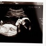 What the Cave Boys Teach Us About Abortion