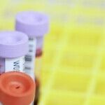 Amid a Dire Blood Shortage, Let Gay Men Donate