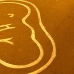 What Left-Wing Abortion Extremism?