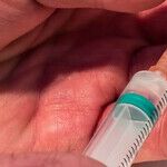 Supervised Injection Facilities Save Lives: The Justice Department's Opposition to Such Harm-Reducing Programs Is Irrational, Unscientific and Inhumane