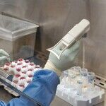 What the First Coronavirus Deaths Tell Us