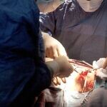 Do You Have a Donor Card?